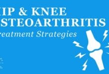 Diagnosis and Treatment of Hip & Knee Osteoarthritis